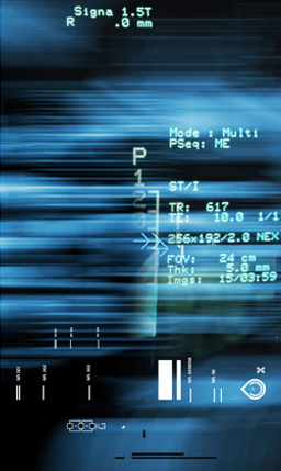 Interface